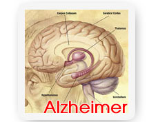 Protein changes in heart indicate Alzheimer''s disease linked with heart failure