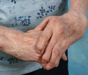 Drinking Lessens Risk Of Rheumatoid Arthritis