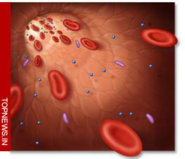 Bacteria can directly cause blood clotting