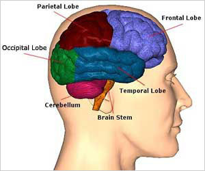 Protective effect can be shown on brains of multiple sclerosis patients by exercise