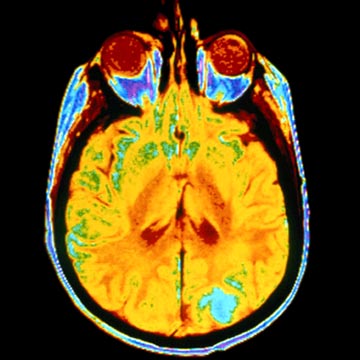 ‘Brain Scans’ is being misused as lie detector test