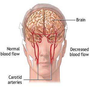 U.S. newsletter advises ways to preserve executive brain function