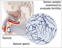 The bum jab that may make condoms history