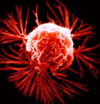 Human Body Cancer