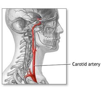 stenting