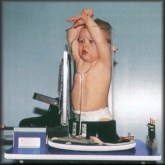 Child-X-Ray