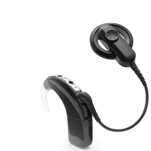 Cochlear’s underlying profit falls 16% to $132.6 million