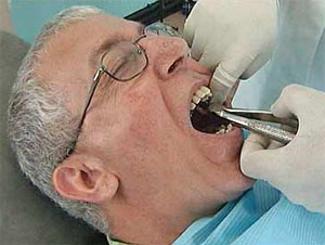 New Plasma Technology Looks to Reduce "Dentist Pain"