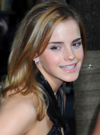 Emma Watson Family Photos. Emma Watson