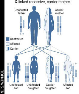 Gene linked to muscular dystrophy-related vision problems identified