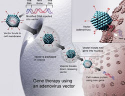 Gene therapy, hope of vision for LCA patients