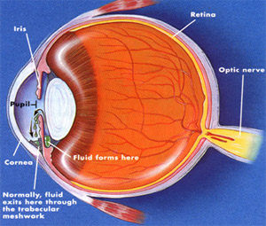 Glaucoma, a leading cause of blindness, can sneak