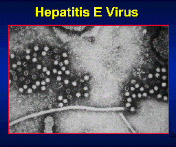More Than 160 Hepatitis E Cases In Shimla Since Mid-January