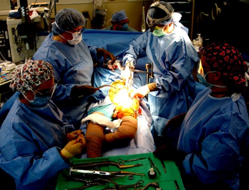 Hip-Replacement-Surgery