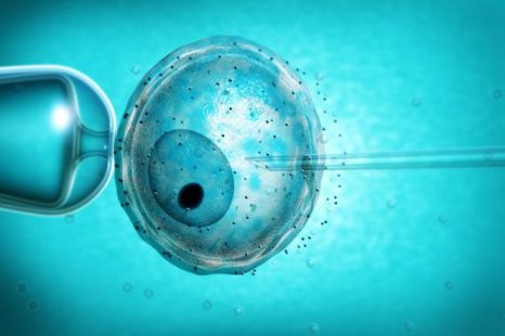 NHS might offer free IVF to Same-Sex Couples Under a new proposal, ... NHS might offer free IVF to Same-Sex Couples Under a new proposal, ...