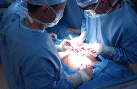 Lax surgeries