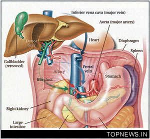 Liver transplant patients at increased cancer risk