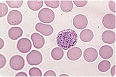  Penn State researchers developing microwaves to roast malaria parasites