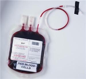 Negligence in blood transfusion causing AIDS