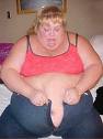 Obese Woman