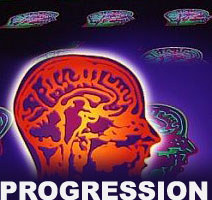Drug rasagiline may slow Parkinson''s progression