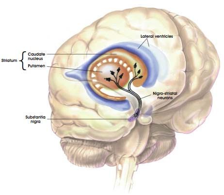 parkinson's disease: recommended foods