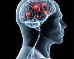 Neurological disease patients increasing in the UK, experts