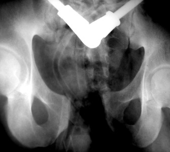 Pelvic-Muscles-Kegal-Exercise