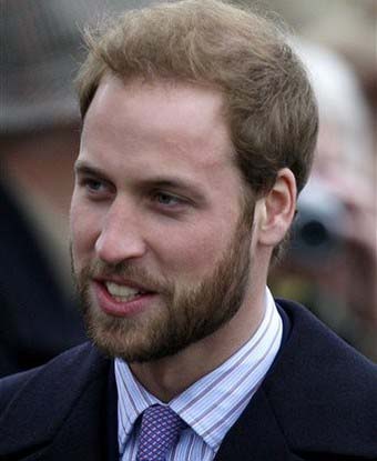 Prince William’s ''Harry Potter'' scar from childhood golfing accident