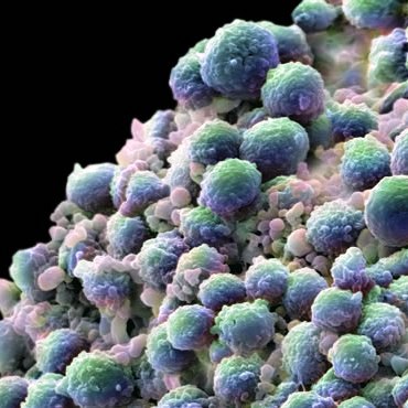 Prostate-Cancer-Cells