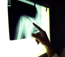 Now, minimal radiation exposure during radio imaging possible