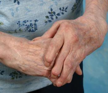 Bee Sting Helpful In Treating Rheumatoid Arthritis