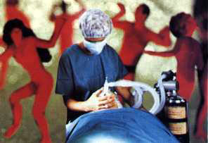 Sexual Hallucinations in Patients Due to Anesthesia