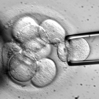 Vision can be restored by stem cell treatment
