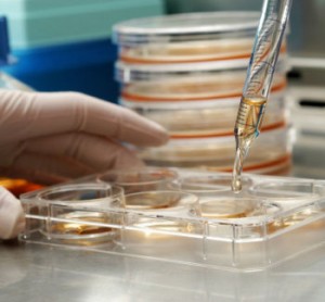 Stem-Cell-Therapy