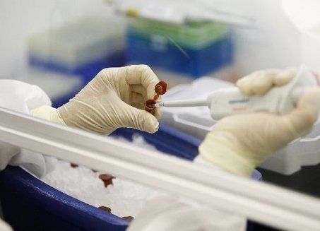 125 new swine flu cases reported