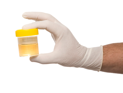 Urine test may help diagnose pneumonia early 