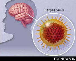 Japanese Encephalitis Virus