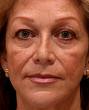 Scientists discover “anti aging genes”