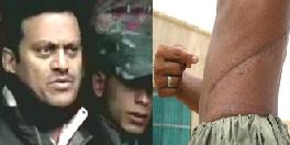 Kidney racket kingpin Dr. Amit handed over to Indian authorities