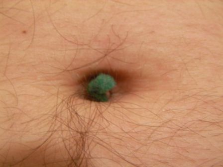Mystery behind male belly button fluff, a mystery no more