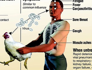 Bird Flu