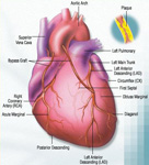 Blood Vessels after Heart Attack