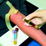 Simple Blood Test