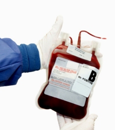 State blood banks fail the Aids test