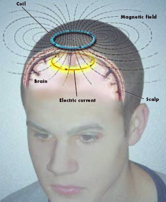Brain Scanning