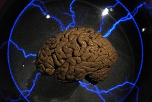 Hi-tech brain implant trial gives hope to Parkinson's disease sufferers