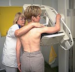 Breast Cancer Gene