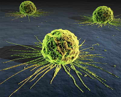 China and India stricken by the growing cancer numbers