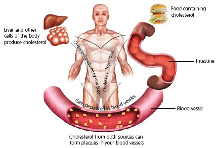 Synthetic HDL cholesterol with gold at its core to control bad cholesterol